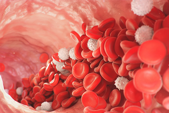 Extravascular Hemolysis and Residual Anemia in Paroxysmal Nocturnal Hemoglobinuria