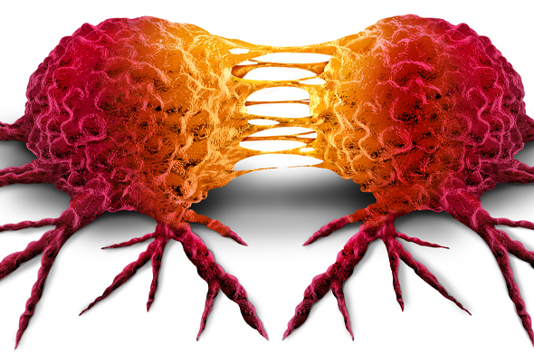 Expert Perspectives in Gastrointestinal Stromal Tumors to Cover Key Topics in GIST Treatment