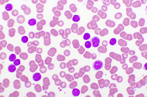 Preserving Antitumor Immune-Mediated Mechanisms of Monoclonal Antibodies