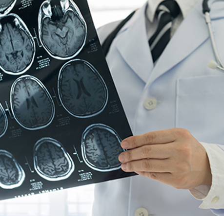 Questions Surrounding Early Use of Ocrelizumab in Patients With  Relapsing Multiple Sclerosis