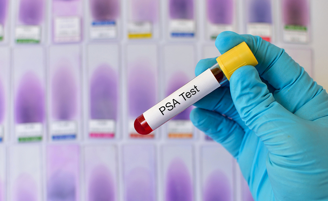 Treating Castration-Resistant Disease