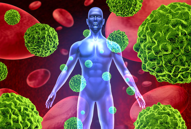 Oligometastatic Prostate Cancer: Can We Get to Cure?