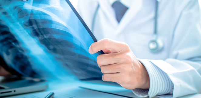 Osseous Metastasis in Metastatic Castration-Resistant Prostate Cancer