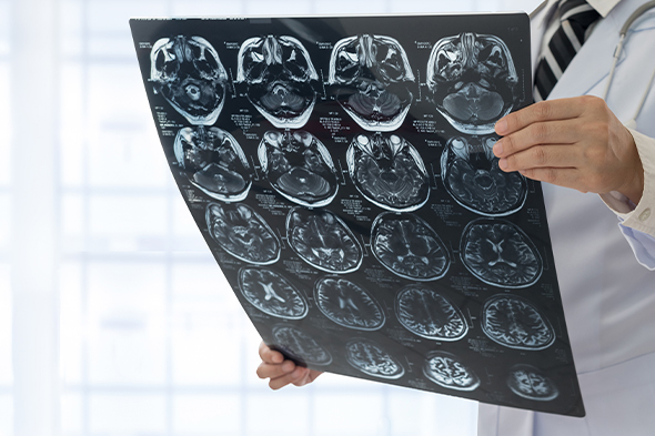 Oligometastatic Non–Small Cell Lung Cancer: Definitions and Treatment Principles