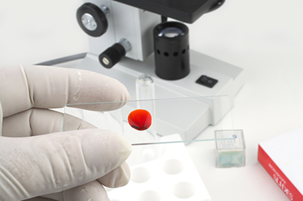 Proper Clinical Diagnosis Is Essential in Primary Immune Thrombocytopenia