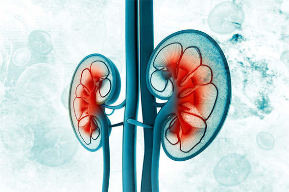 Challenges in Managing Complement 3 Glomerulopathy