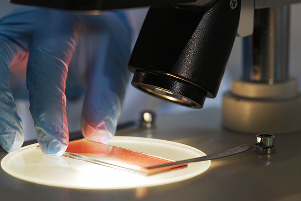 Management of Breakthrough Hemolysis in Paroxysmal Nocturnal Hemoglobinuria