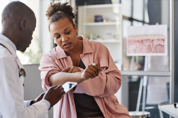 Chronic Spontaneous Urticaria: Disease Burden and Impact